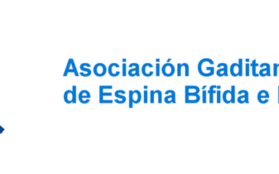 Vocalía de Caridad: Entrega de donativo a la Asociación Gaditana de Espina Bífida e Hidrocefalia (AGEBH).